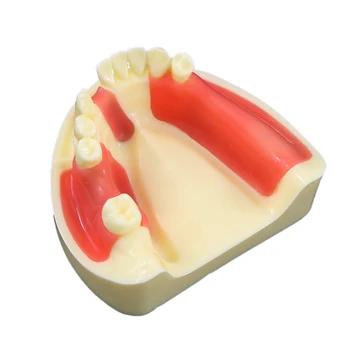 Стоматологическая модель зубов, практика имплантации, Typodont Overdenture, Реставрация нижней челюсти, Демонстрация M2004 для изучения преподавания